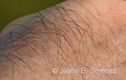 Hairs in My Arm